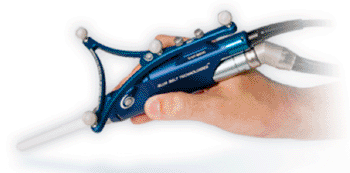 Imagen: La pieza de mano del Sistema NavioPFS Robotic Resurfacing (Fotografía cortesía de Blue Belt Technologies).